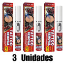 Caneta Removedora de Tatuagens - RemovalClean