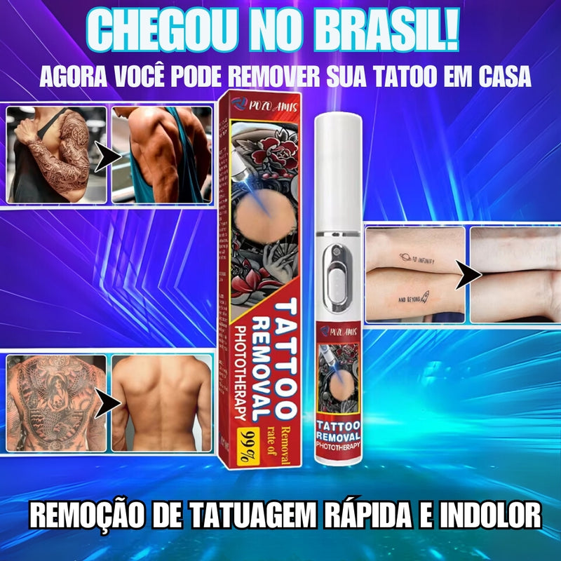 Caneta Removedora de Tatuagens - RemovalClean