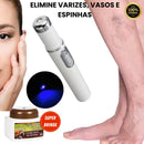 Caneta Laser Removedora de Varizes Variclean [BRINDE]