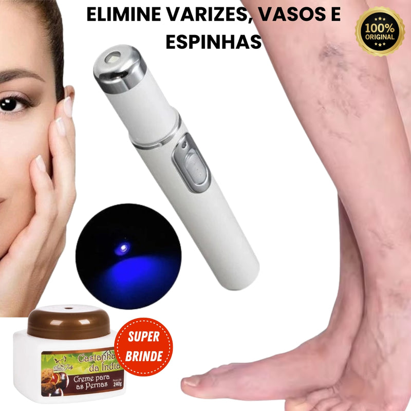 Caneta Laser Removedora de Varizes Variclean [BRINDE]