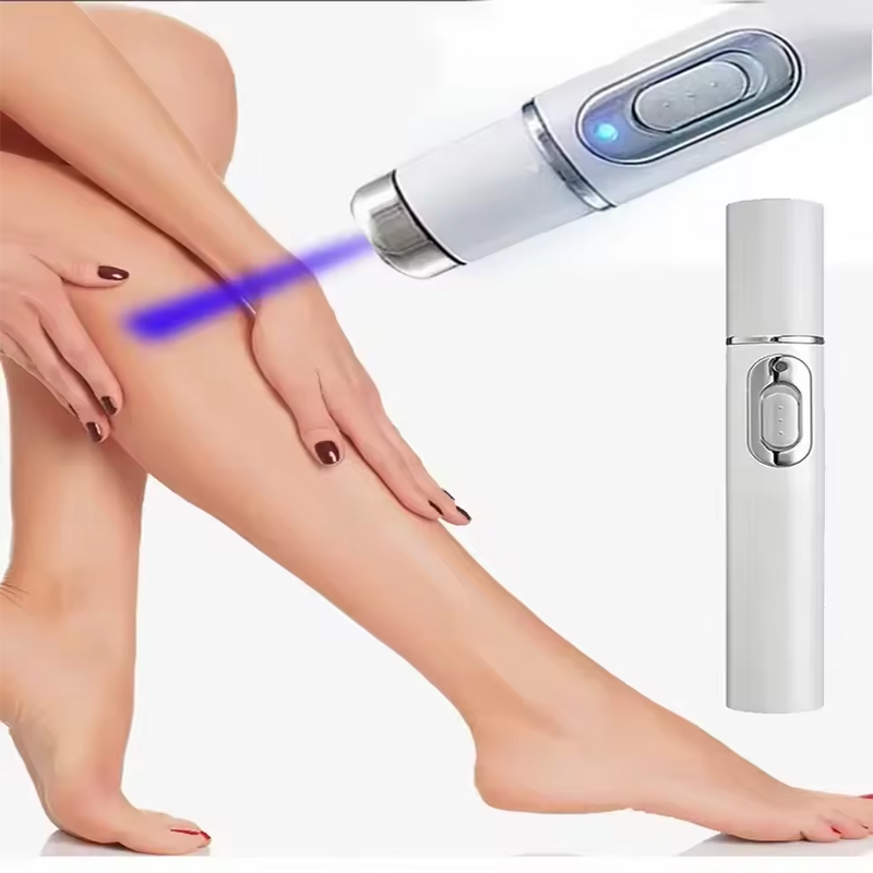 Caneta Laser Removedora de Varizes Variclean [BRINDE]